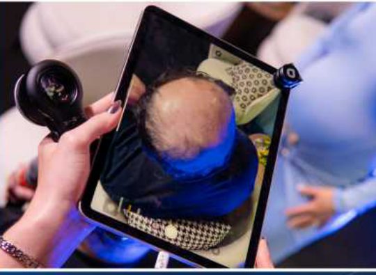 Exame de tricoscopia sendo exibido em tablet durante a imersão
